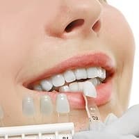DENTAL VENEERS AND DENTAL LAMINATES