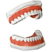 DENTURES AND PARTIAL DENTURES