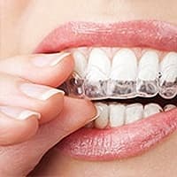 INVISALIGN®