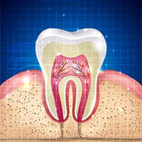 ROOT CANALS