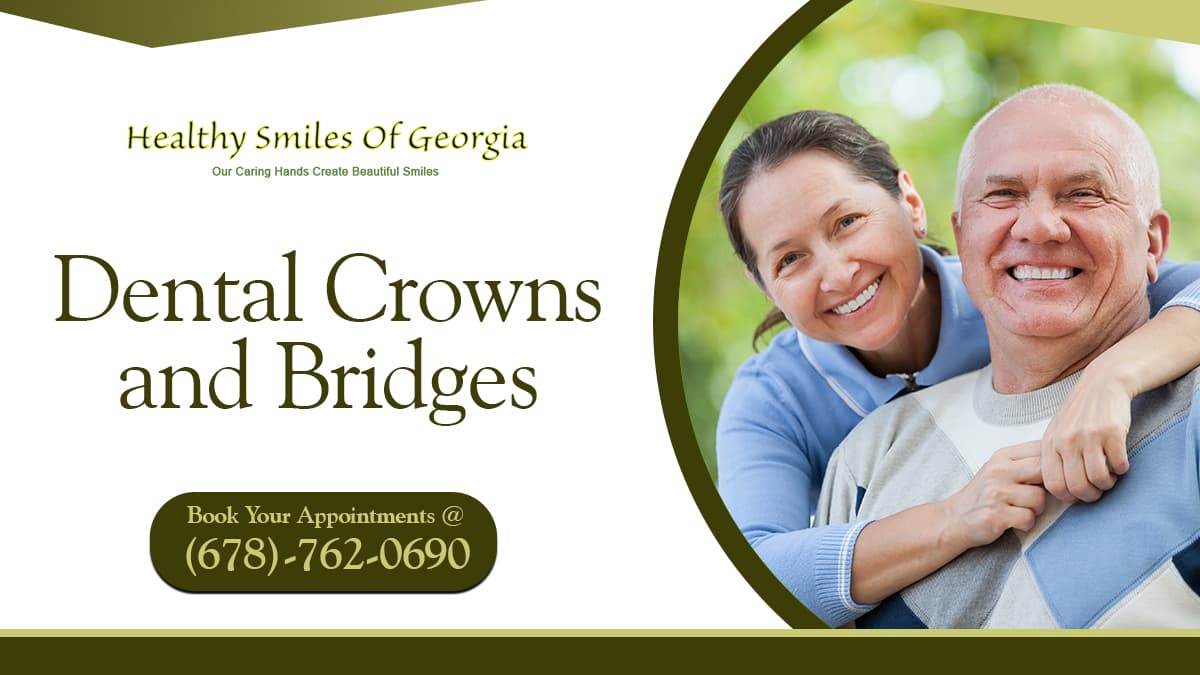 What Are Dental Crowns and Bridges?