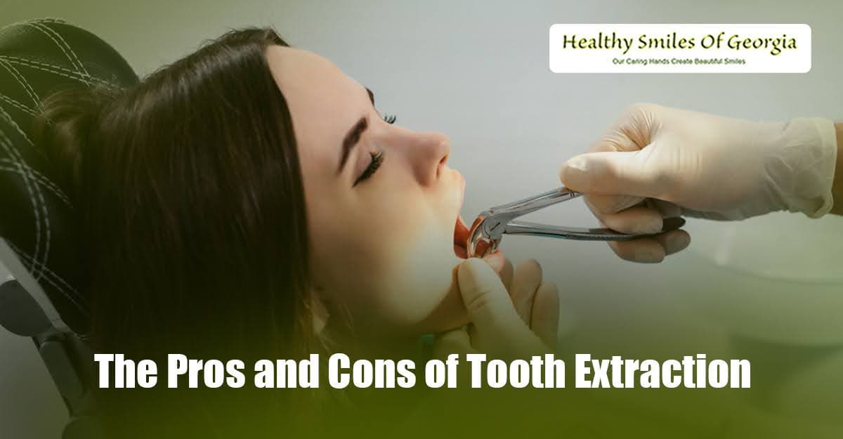 The Pros and Cons of Tooth Extraction