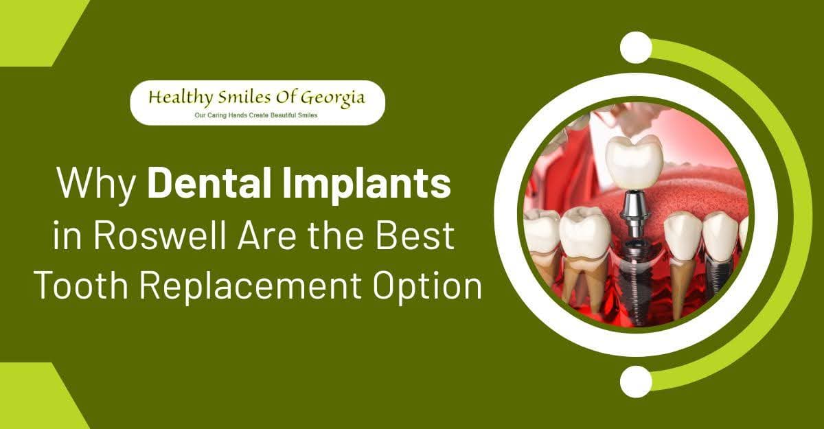 Why Dental Implants in Roswell Are the Best Tooth Replacement Option
