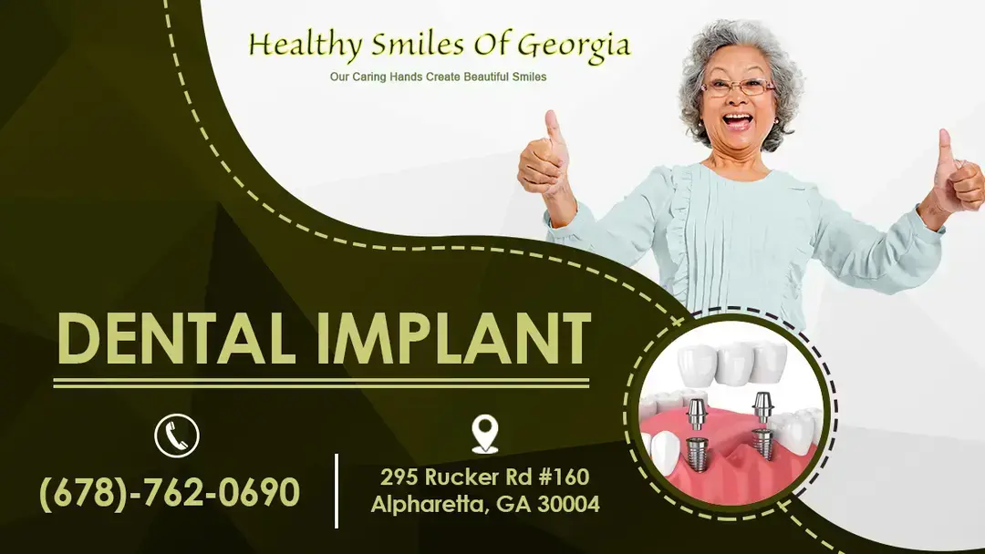Are You an Ideal Candidate for Dental Implants?