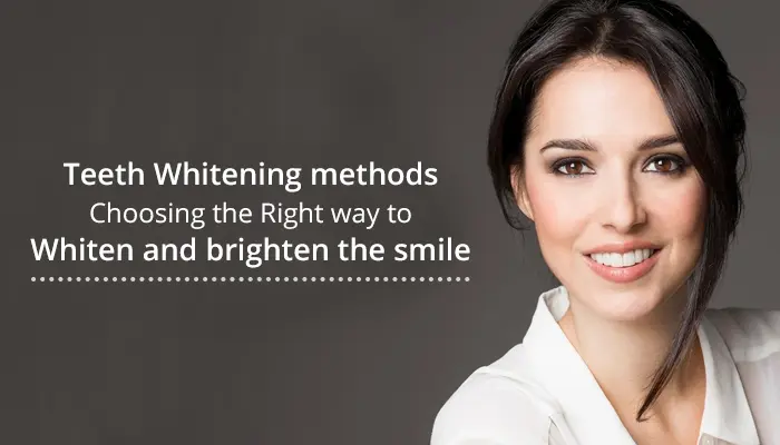Teeth Whitening Methods: Choosing the Right Way to Brighten Your Smile