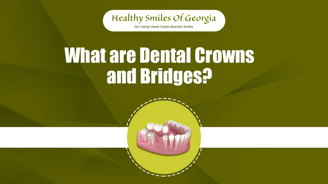 What Are Dental Crowns and Bridges? A Complete Guide
