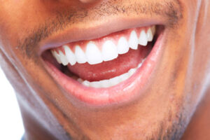 Your Gum Health Is Critically Important and a Periodontist in Alpharetta Can Keep Gums Healthy