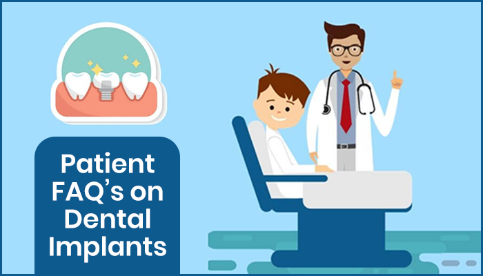 Blog HSG Dental Implant