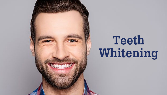 Blog HSG Teeth Whitening